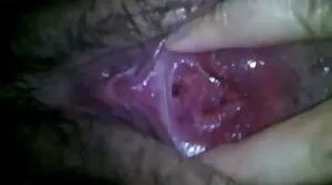 ماں کے ہاتھ میں پھنس سنک